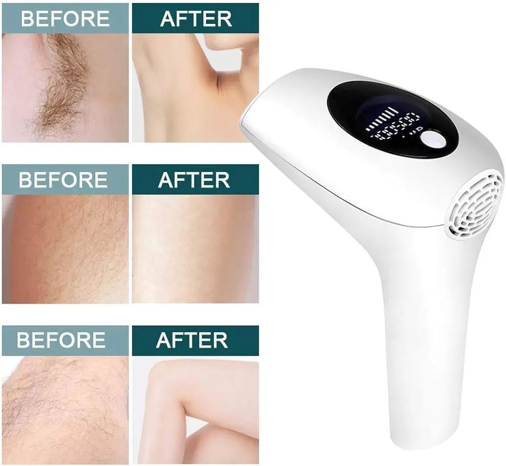 IPL Hair Removal Device – 8 Power Levels, 900,000 Flashes, Manual & Auto Modes