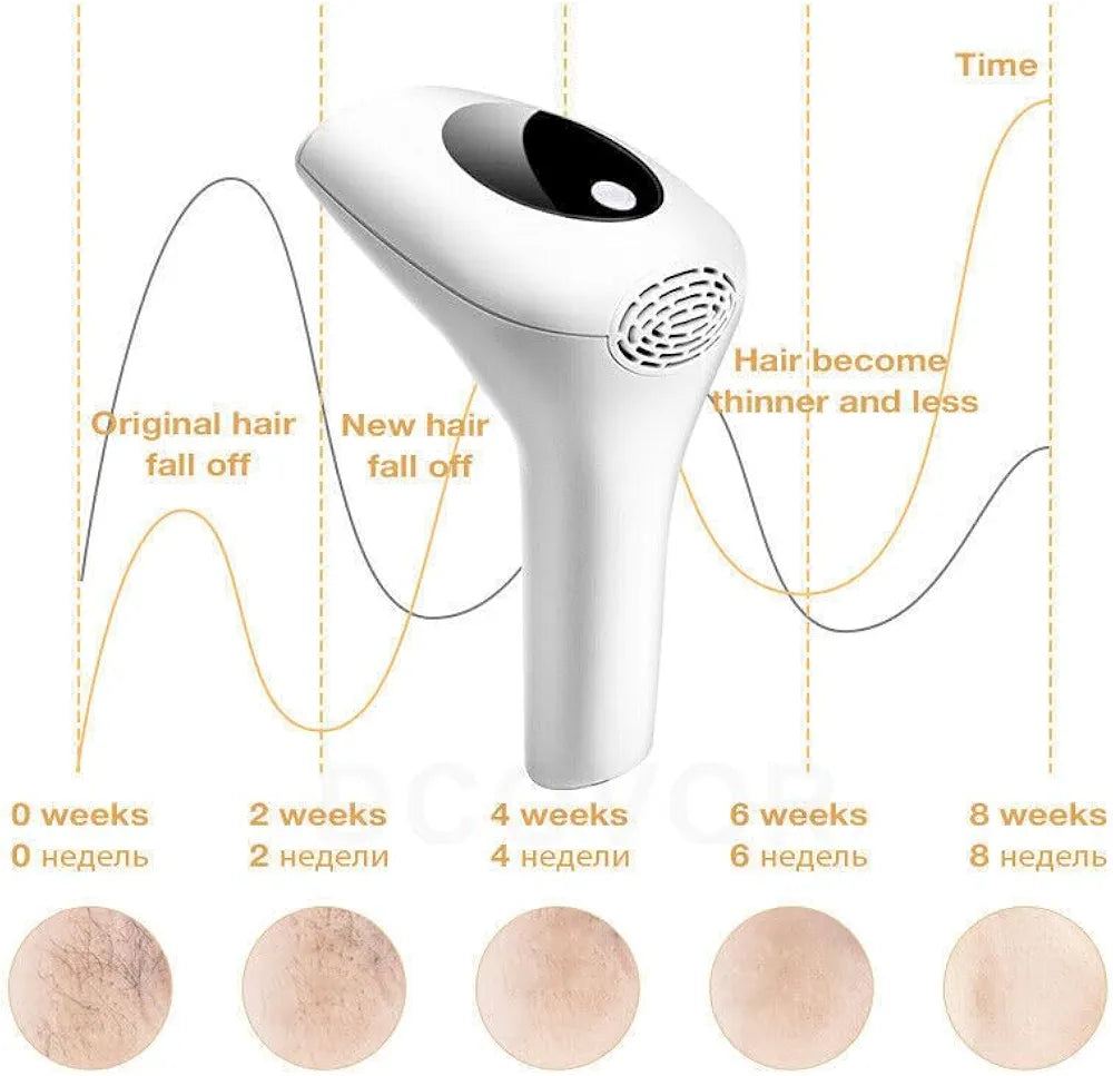 IPL Hair Removal Device – 8 Power Levels, 900,000 Flashes, Manual & Auto Modes